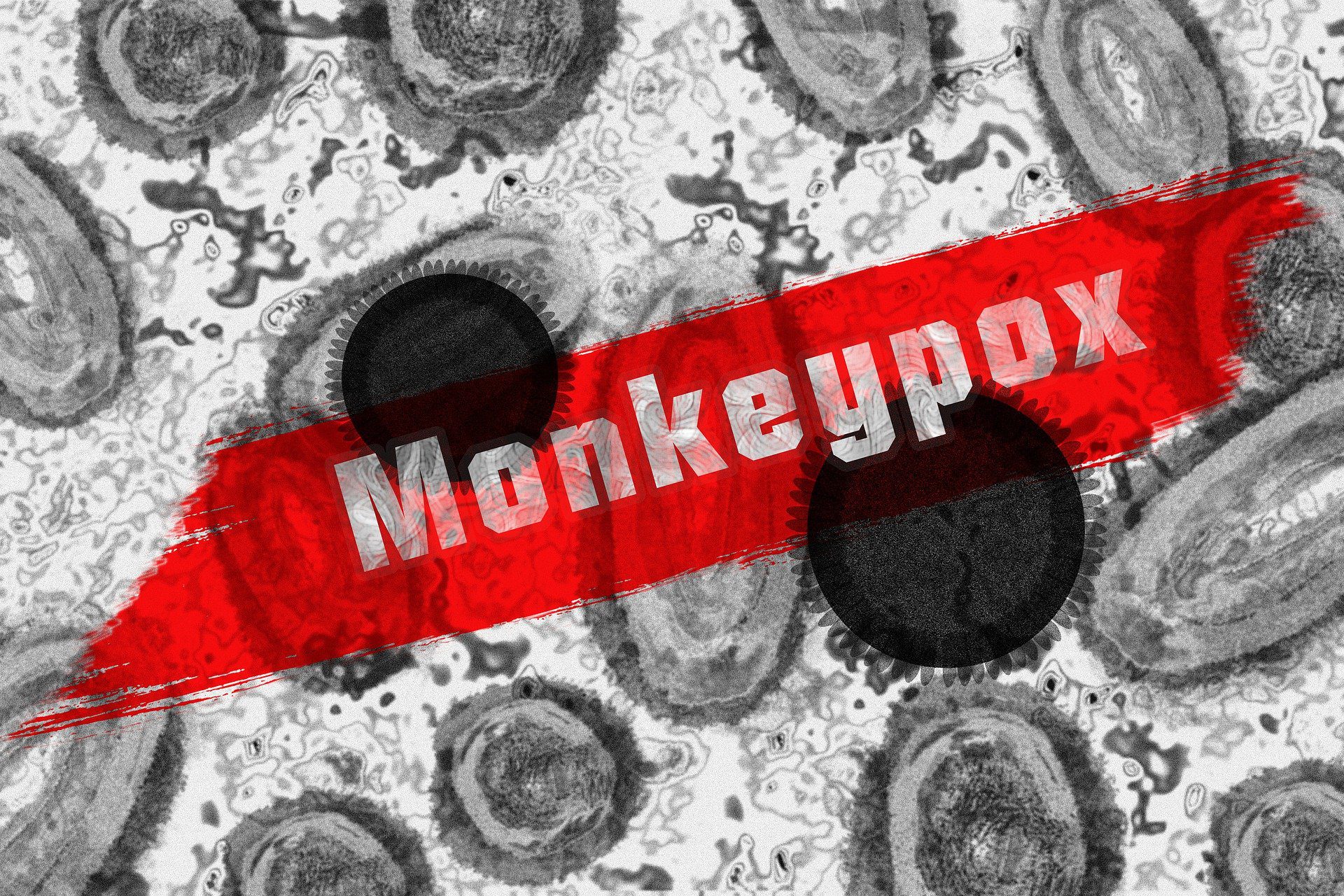 fotografia de células sob o microscópio é sobreposta ao texto "monkeypox"monkeypox
