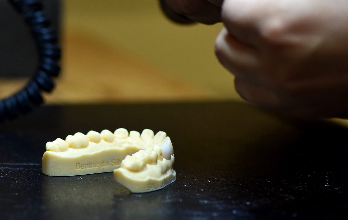 imagem de modelo de arcada dentária